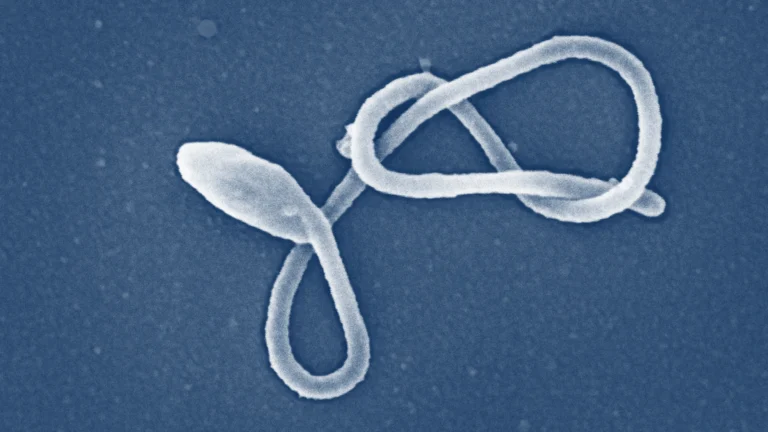 Ebola